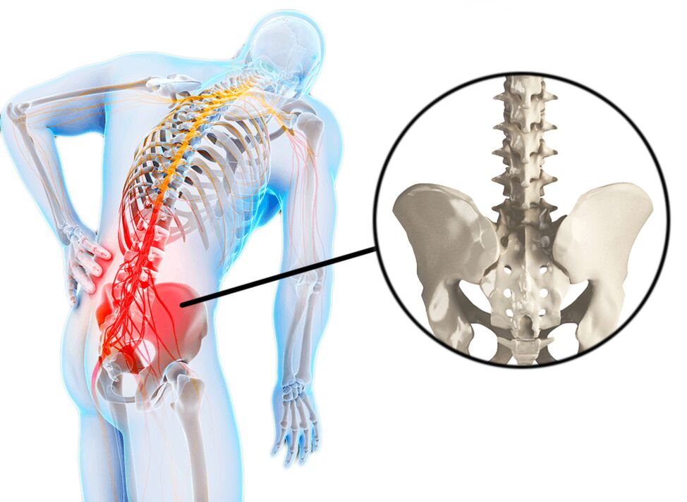 Spinal pathology is a common cause of low back pain