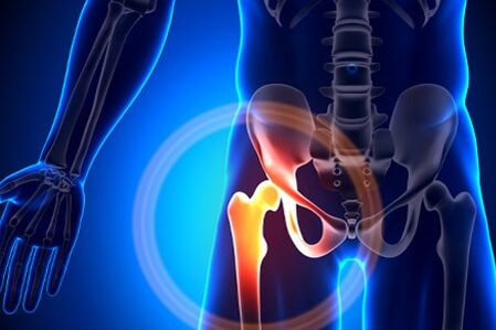 Hip pain