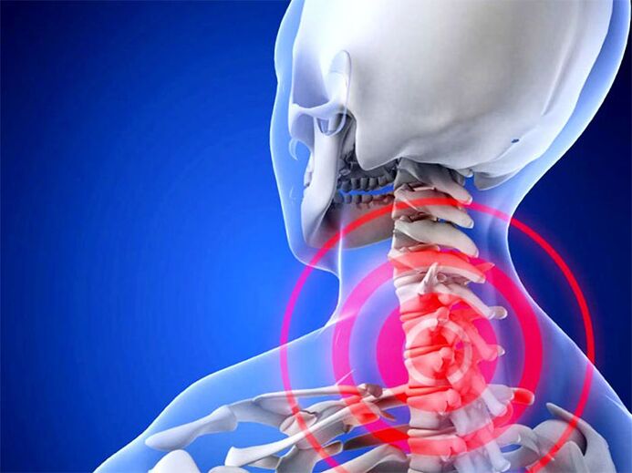 Inflamed cervical area
