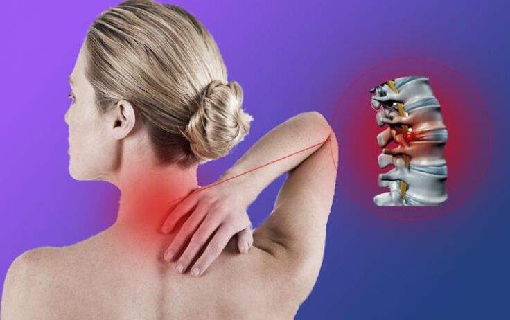 Spine inflammation has cervical osteochondral disease