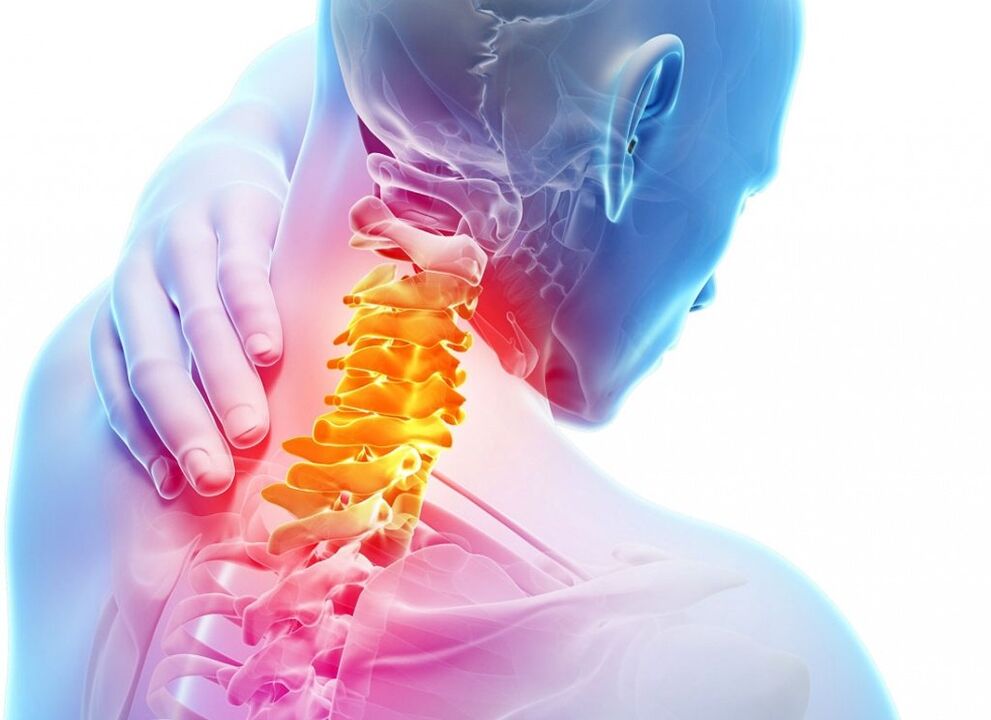 What is cervical osteochondral disease