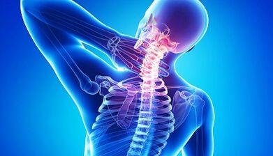 Complications of osteochondrosis in the cervical vertebrae