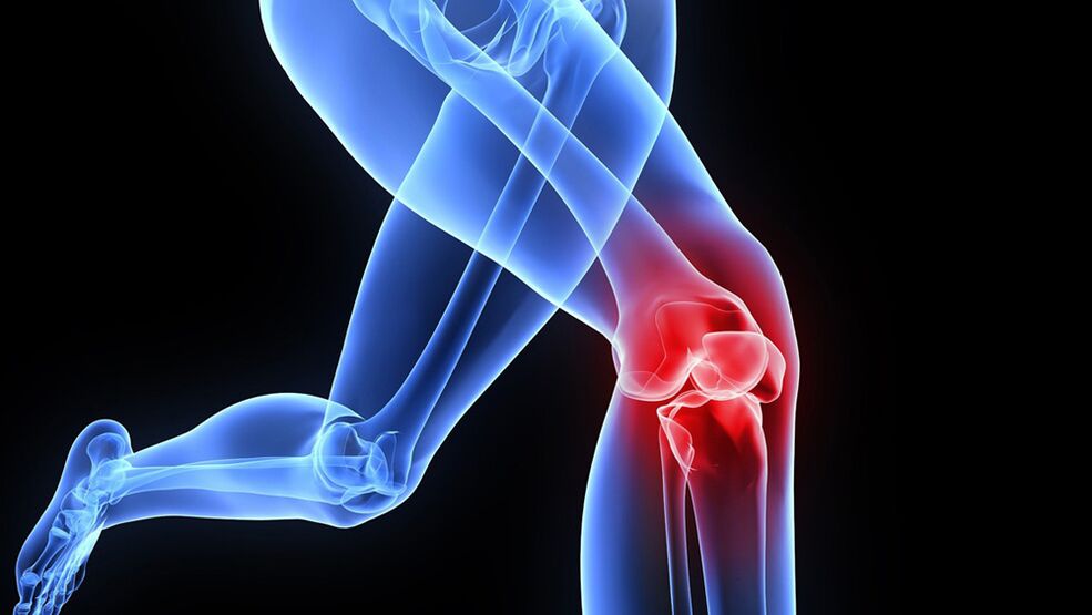 Knee problems caused by joints