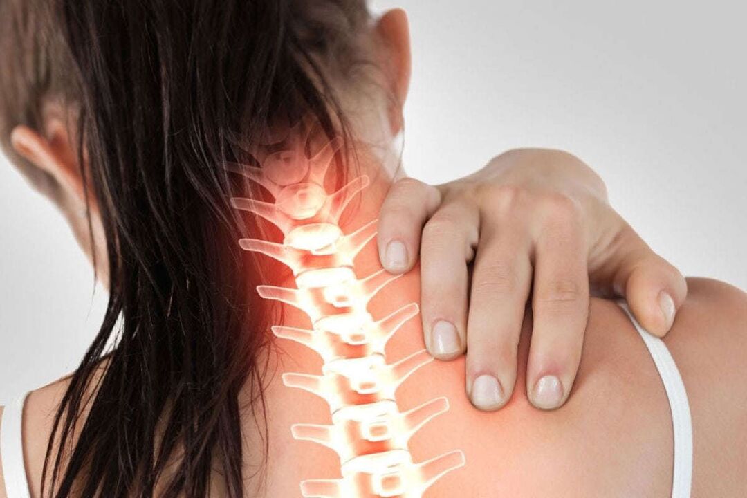 The manifestations of cervical osteochondrosis